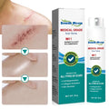 scar remove spray