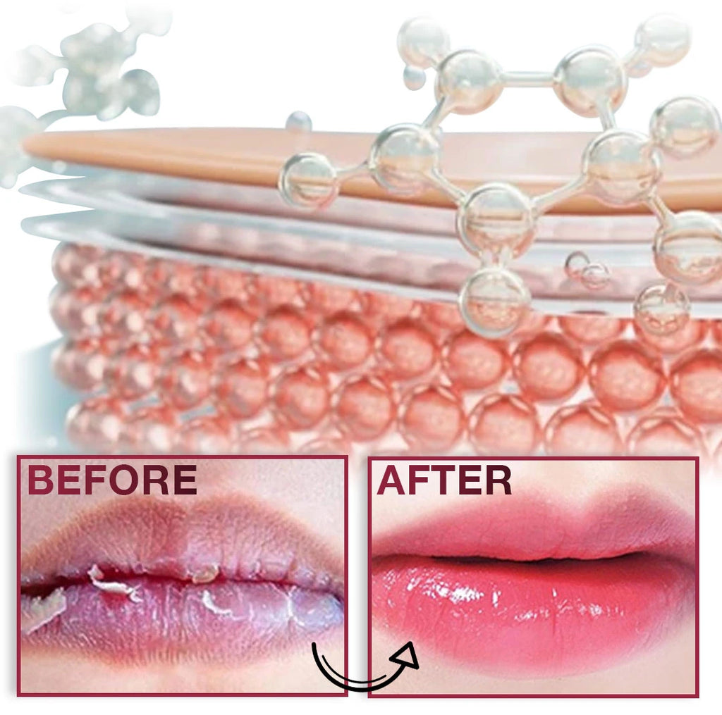Magic Lip Lightening Cream