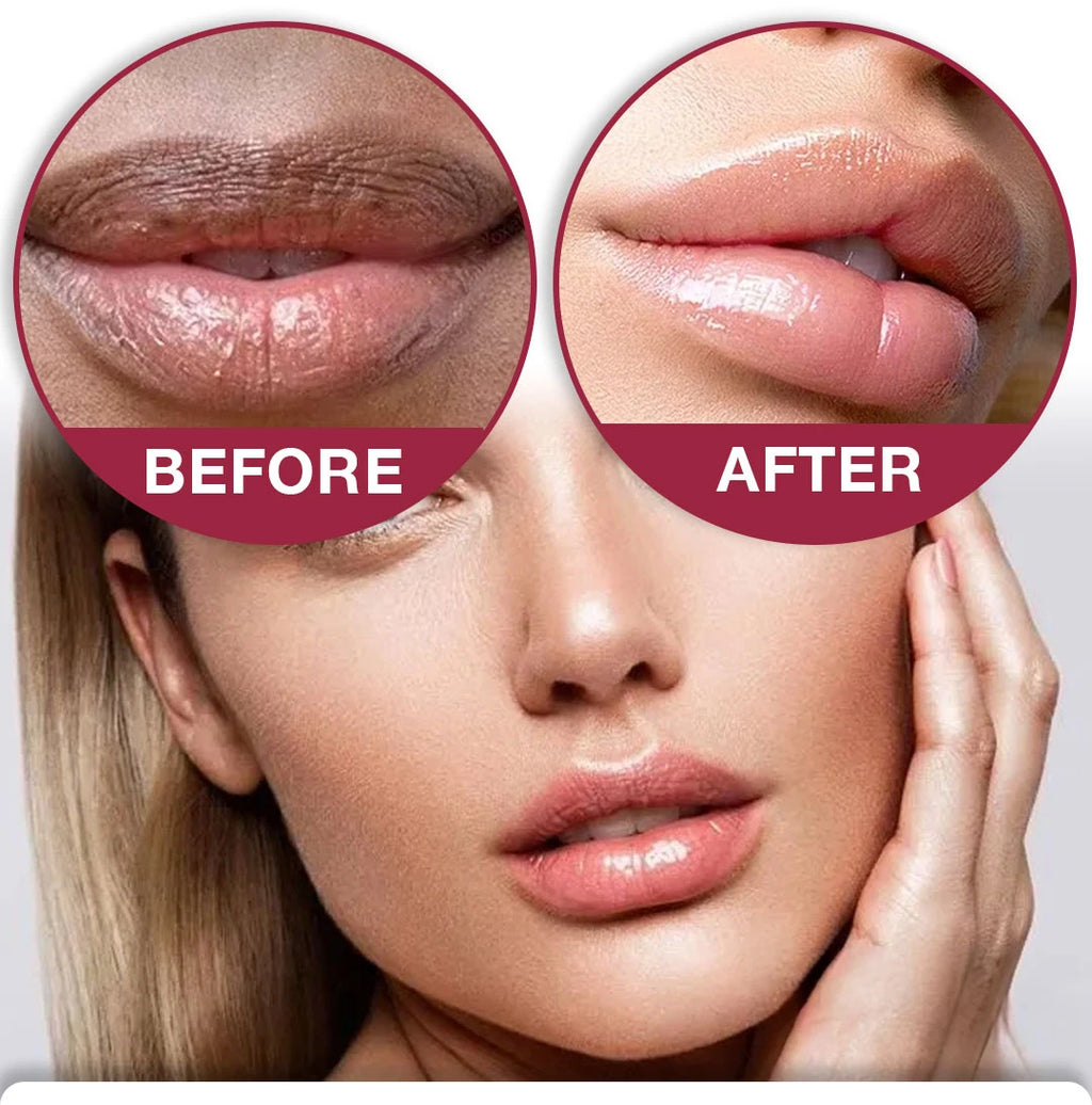 Magic Lip Lightening Cream