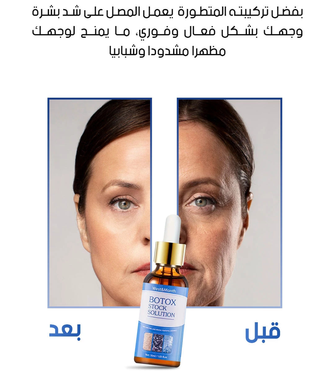 Botox Stock Solution