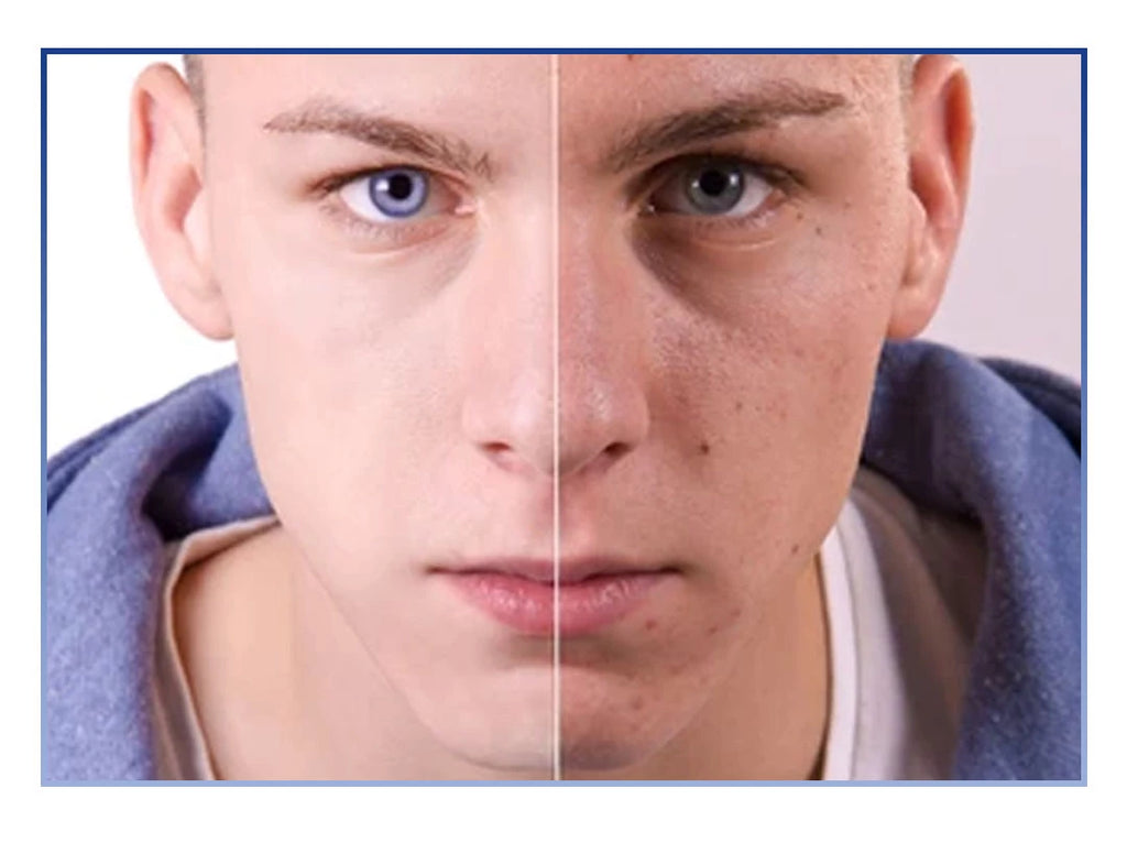 Botox Stock Solution